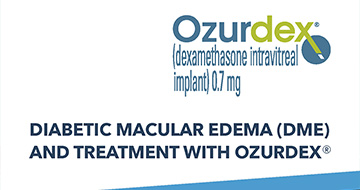 diabetic macular edema  patient brochure