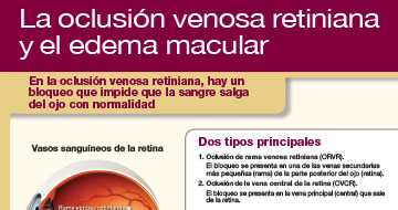 rvo patient education sheet spanish